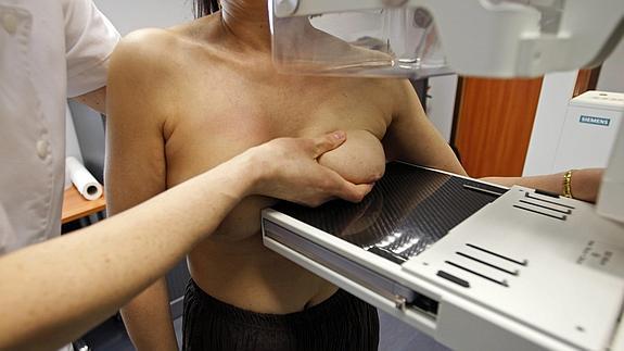 Una mujer se realiza las pruebas para detectar el cáncer.