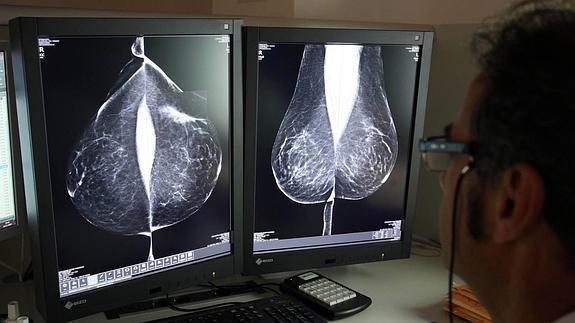 Estudio una mamografía digital, en el servicio de mamografías del Hospital Río Hortega de Valladolid.