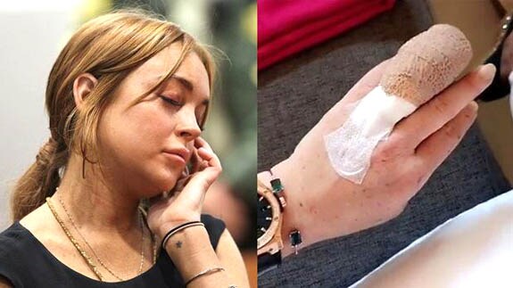 Lindsay Lohan pierde parte de un dedo de una mano en un accidente