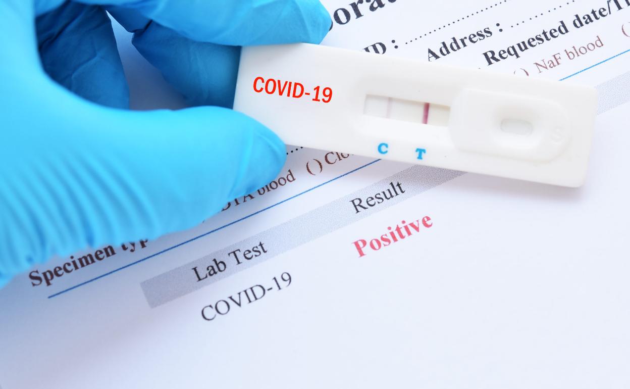 Se investiga la venta privada de test ilegales de Covid-19 en Don Benito-Villanueva
