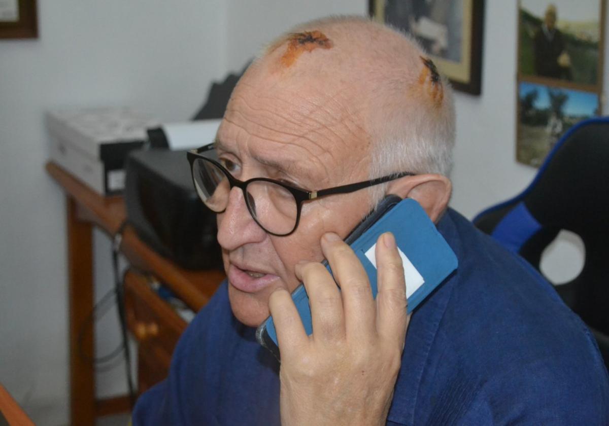 Aún son visibles las herida de la agresión