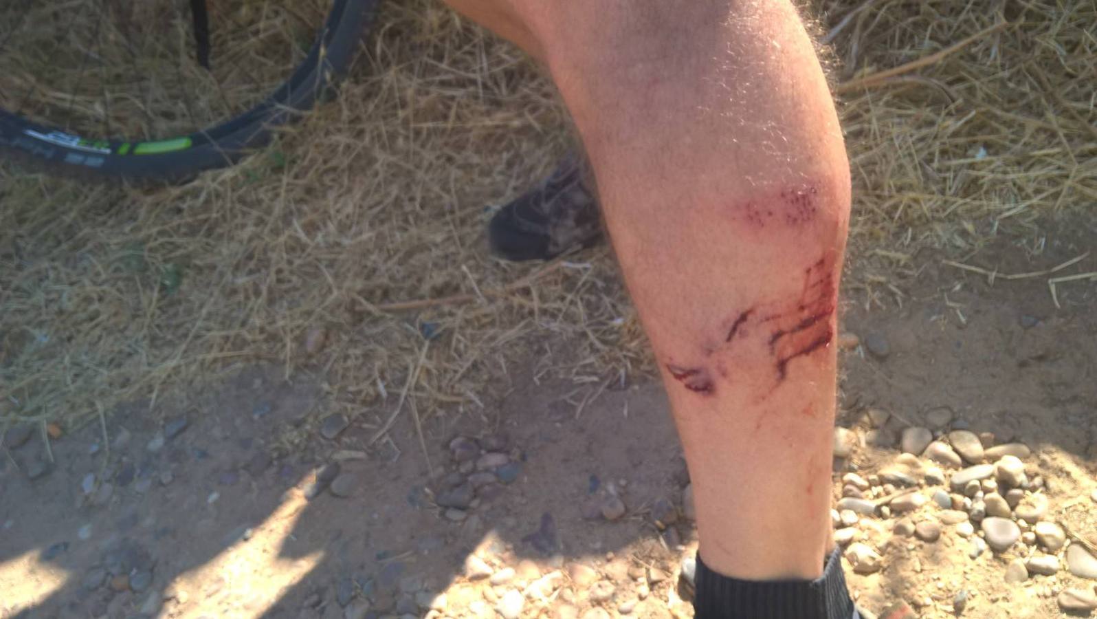 Heridas causadas por el ataque del perro. 