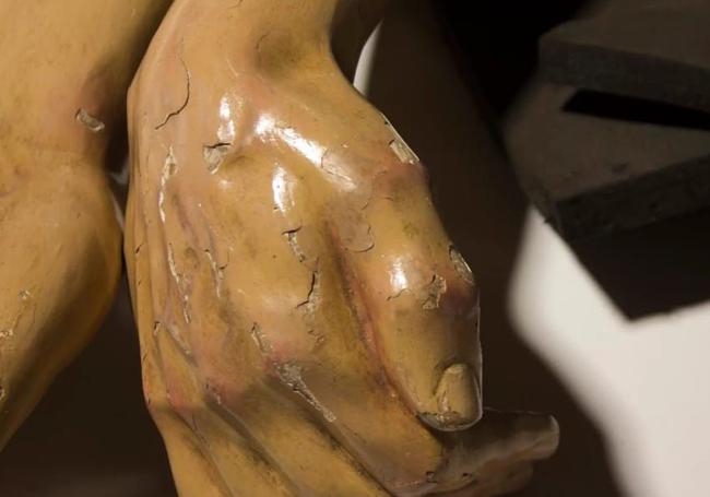 Estado de una de las manos