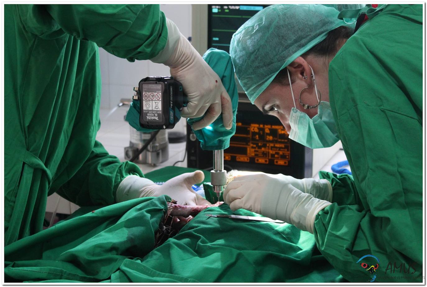 Operacion del Milano real 