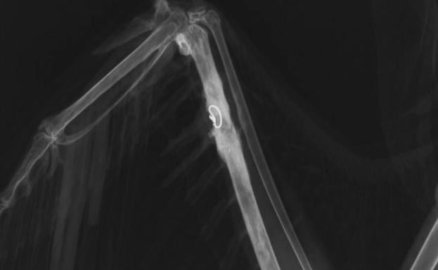 Imagen radiográfica postquirúrgica en la que se aprecia la consolidación ósea del implante.