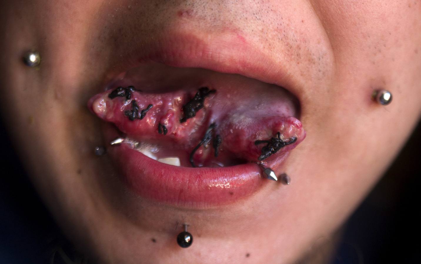 Los tatuajes extremos