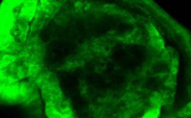 La sobre-expresión del gen Serpent en el ala de Drosophila provoca un sobrecrecimiento permanente y es suficiente para inducir tumores.