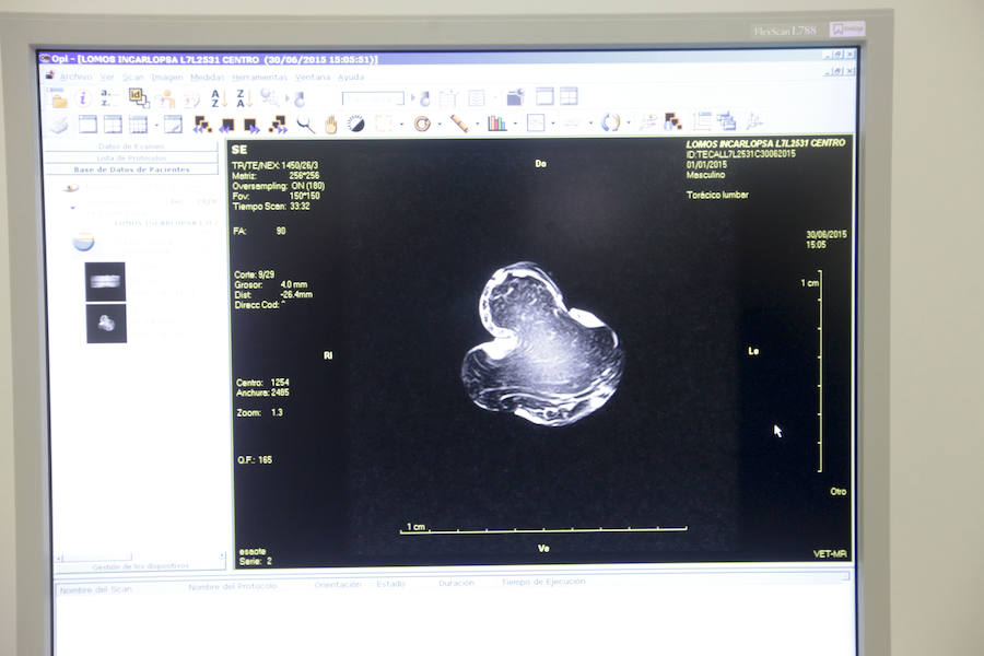 Imagen obtenida del interior de una pieza de lomo tras realizar una resonancia magnética. 