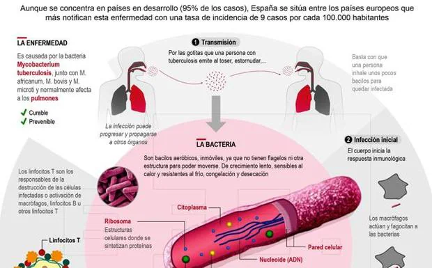 Extremadura repite entre las regiones con menos casos de tuberculosis