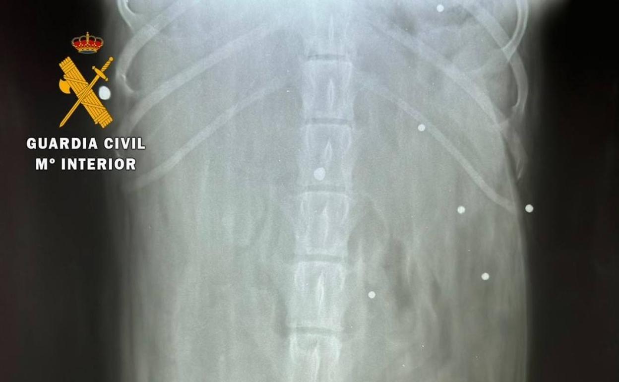 Investigan a un hombre por disparar al perro de su vecina en una finca de Calzadilla