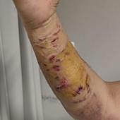 «Temí por mi vida. Los perros no pueden estar sueltos en el campo»