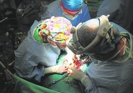 Imagen de archivo de varios cirujanos durante un trasplante.