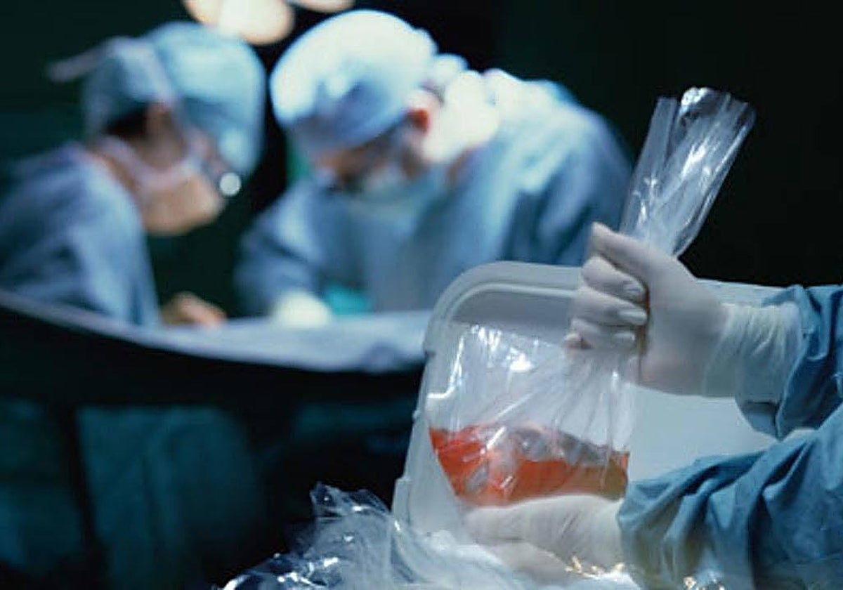 Personal médico durante una operación de trasplante.