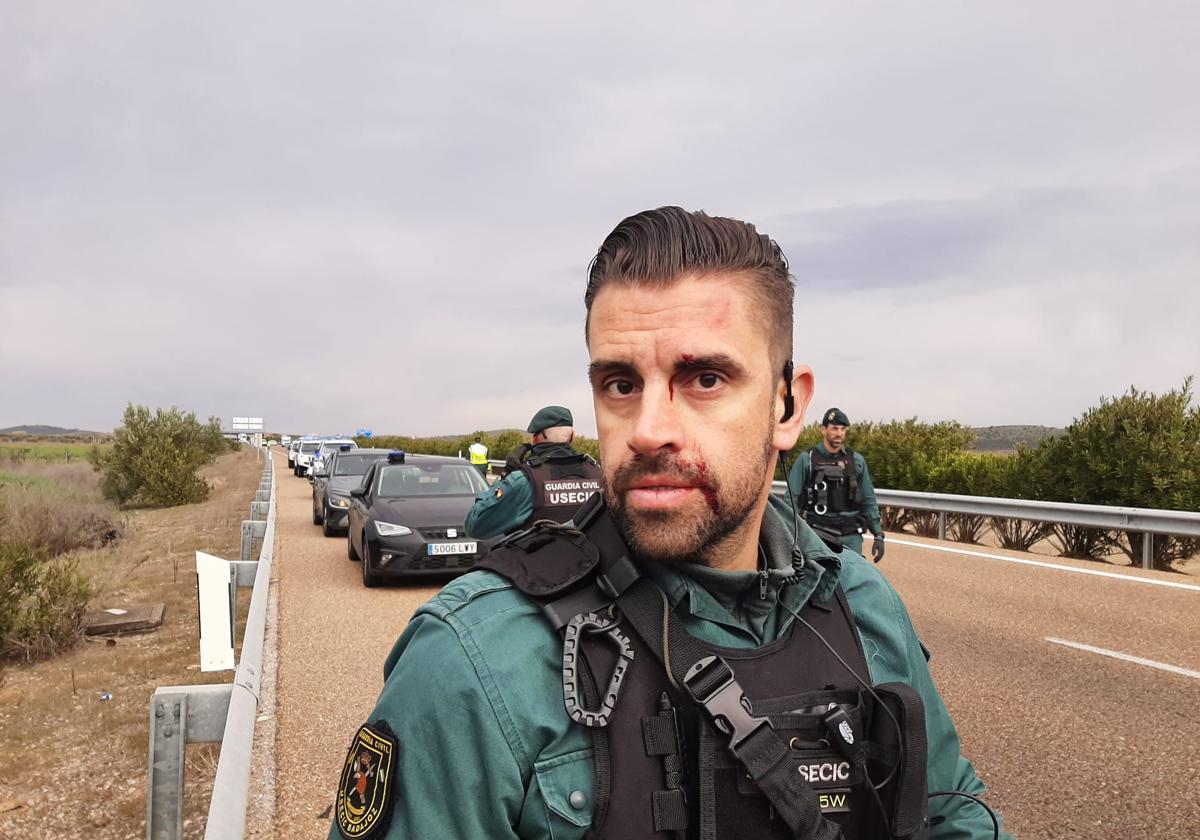 El agente muestra el rostro con sangre tras recibir una pedrada.