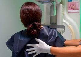 El mamógrafo del hospital de Plasencia sufre una avería, pero se espera que recupere la normalidad este martes