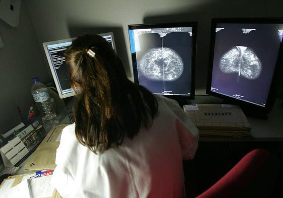 Realización de prueba de imagen para el diagnóstico de cáncer de mama.