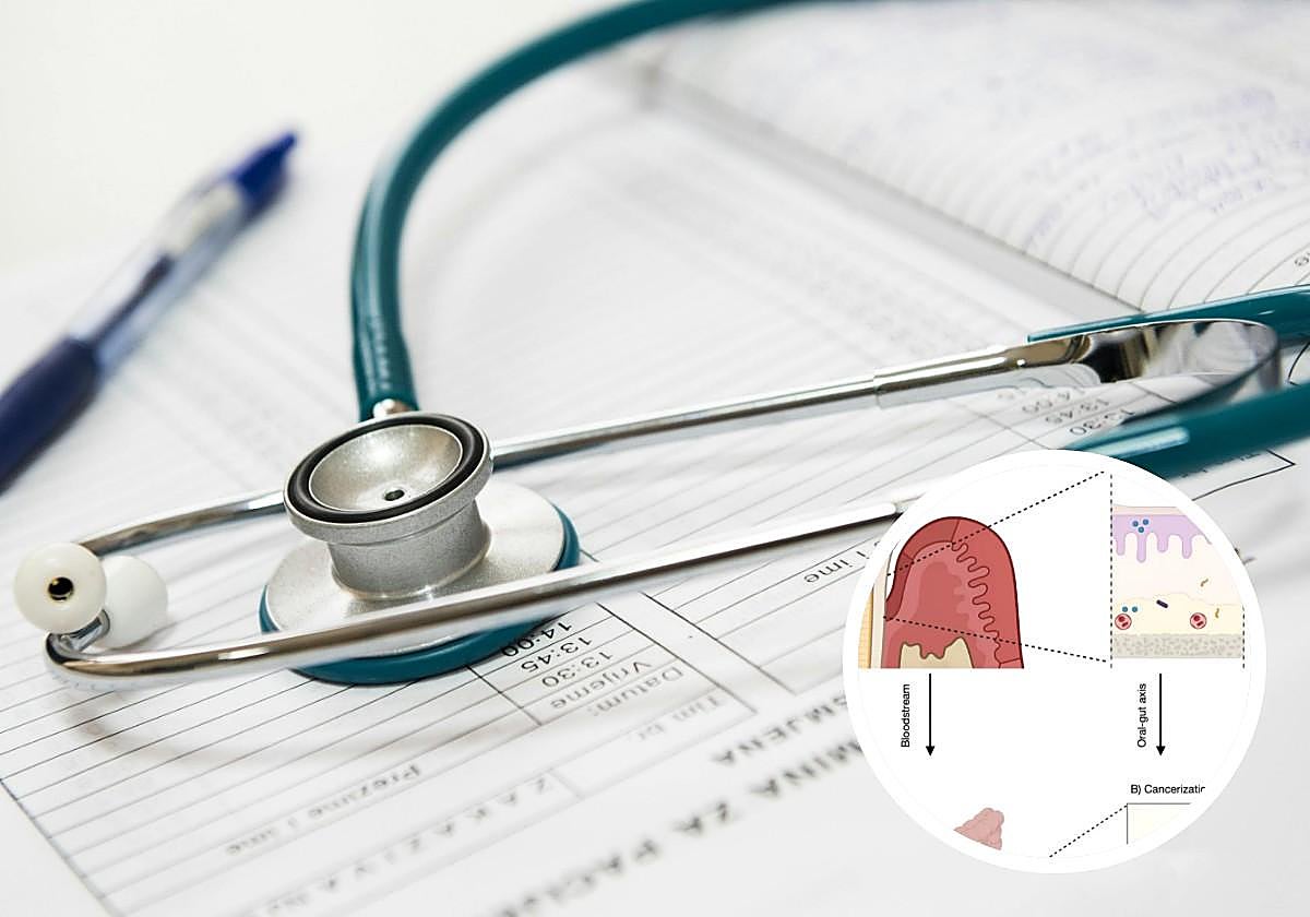 Francisco Mesa Aguado, catedrático, advierte: ignorar la salud bucodental puede aumentar el riesgo de cáncer