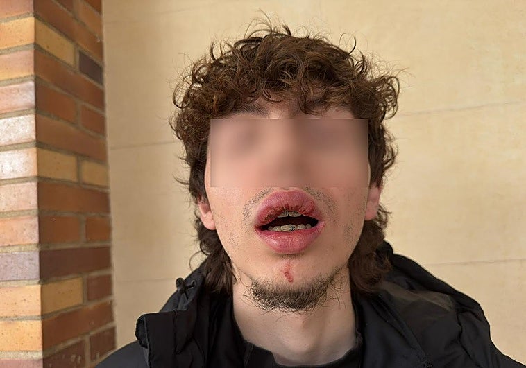 Badajoz busca a la conductora que atropelló a un joven en patinete 