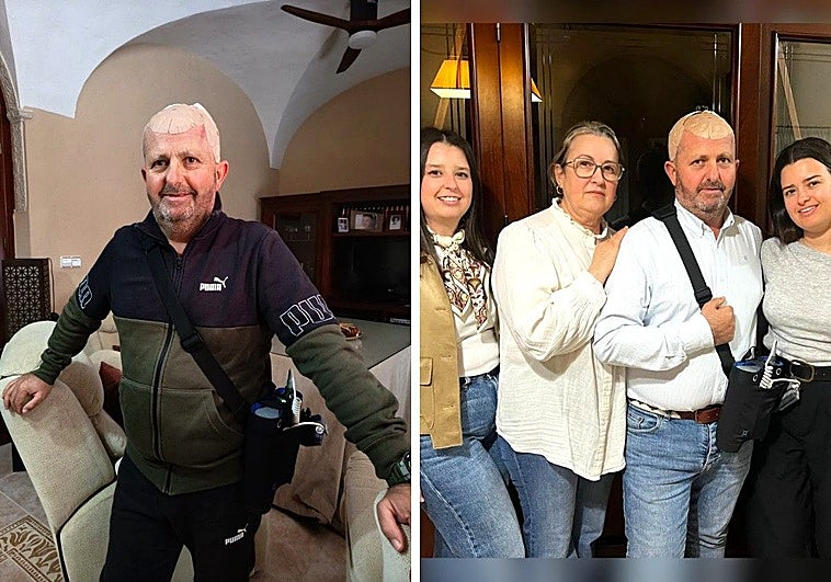 Un vecino de Badajoz, primer extremeño en recibir una nueva terapia contra el cáncer cerebral