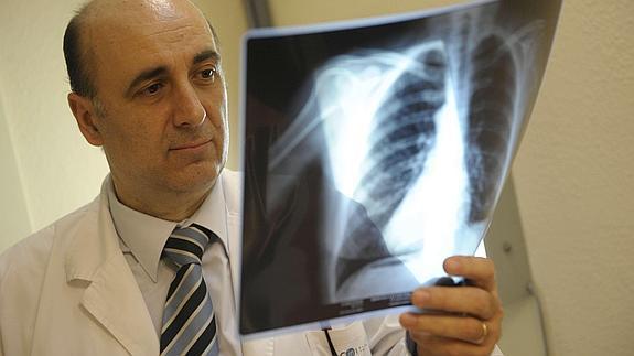 Una radiación menos agresiva contra el cáncer de pulmón