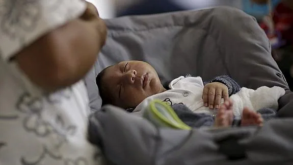 Niño con microcefalia en un hospital de Recife, Brasil.