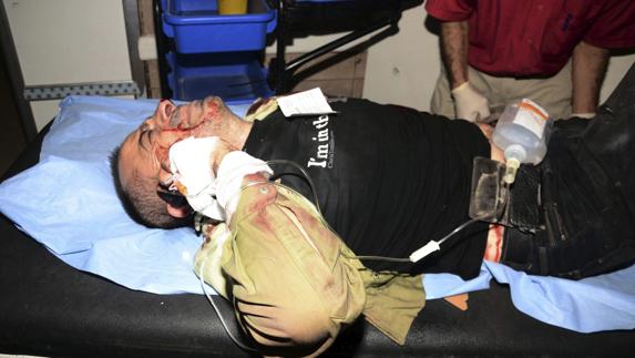 Un hombre herido recibe asistencia médica en un hospital de Alepo.