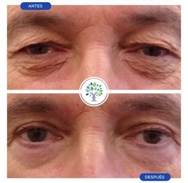 Resultados de un paciente.