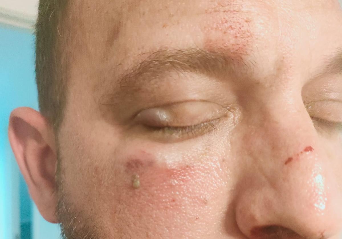 Fractura de mandíbula, lesiones y amenazas: un detenido por agredir a un guardia civil fuera de servicio en Roquetas