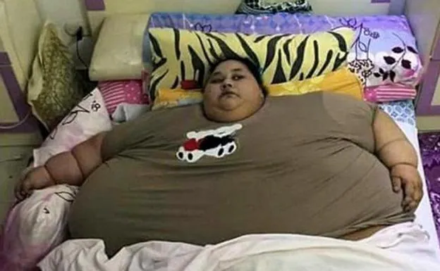 Fallece la mujer más obesa del mundo