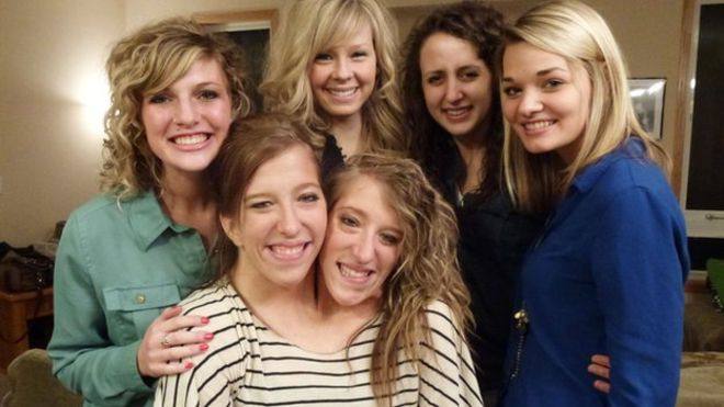 Brittany y Abby Hensel son del estado norteamericano de Minessota y guardan una historia peculiar