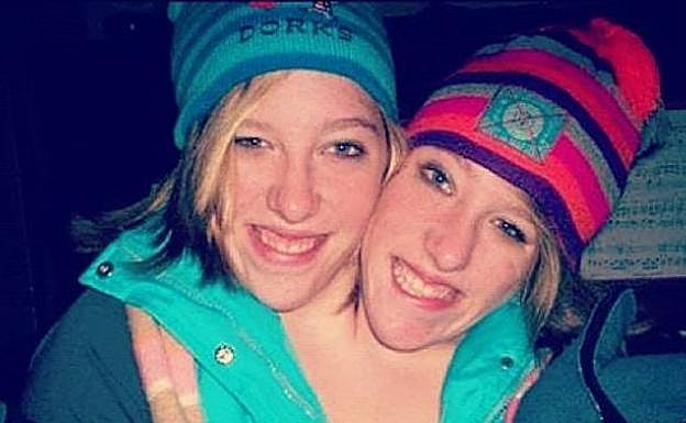 Dos hermanas siamesas se convierten en un ejemplo de superación y logran cumplir su sueño