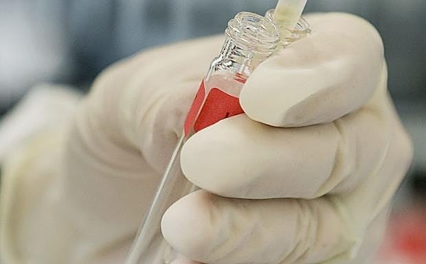 Desarrollan en la UJA un nuevo método de control antidopaje con resultados precisos en sólo un día