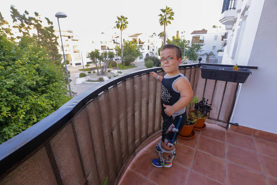 Luis Alberto es un niño motrileño de 12 años, con acondroplasia, que ha tenido la valentía de someterse a una dura operación para ganar 15 centímetros de altura y, sobre todo, mucha autonomía. 