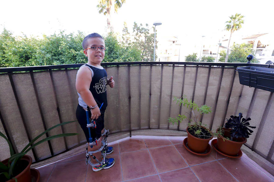 Luis Alberto es un niño motrileño de 12 años, con acondroplasia, que ha tenido la valentía de someterse a una dura operación para ganar 15 centímetros de altura y, sobre todo, mucha autonomía. 