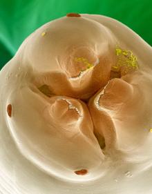 Imagen secundaria 2 - Foraminífero bentónico, Gorgojo y Anisakis 