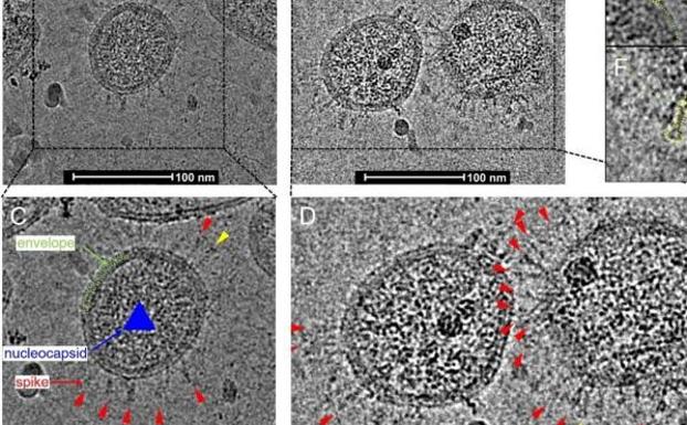 Imagenes del coronavirus captadas con un microscopio electrónico.