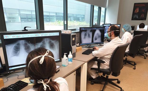 Los investigadores analizan dos radiografías de tórax de los pacientes: uno con COVID19 y otro sin la enfermedad. 
