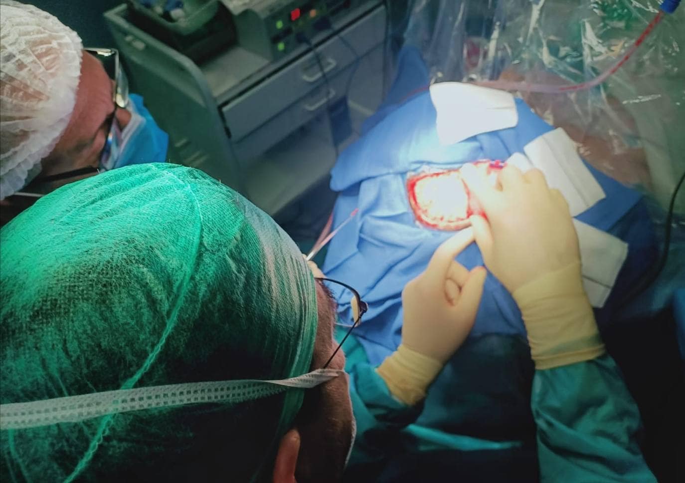 Profesionales Realizan En Jaén La Primera Operación Craneal En Paciente ...