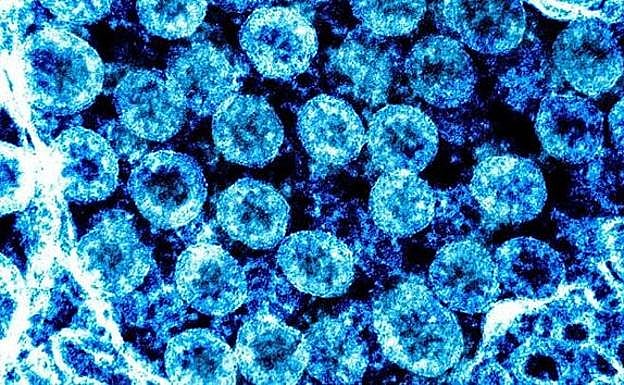 Aviso de un matemático: «La aparición del virus X, avanzado por la OMS, nos atacará de nuevas formas»