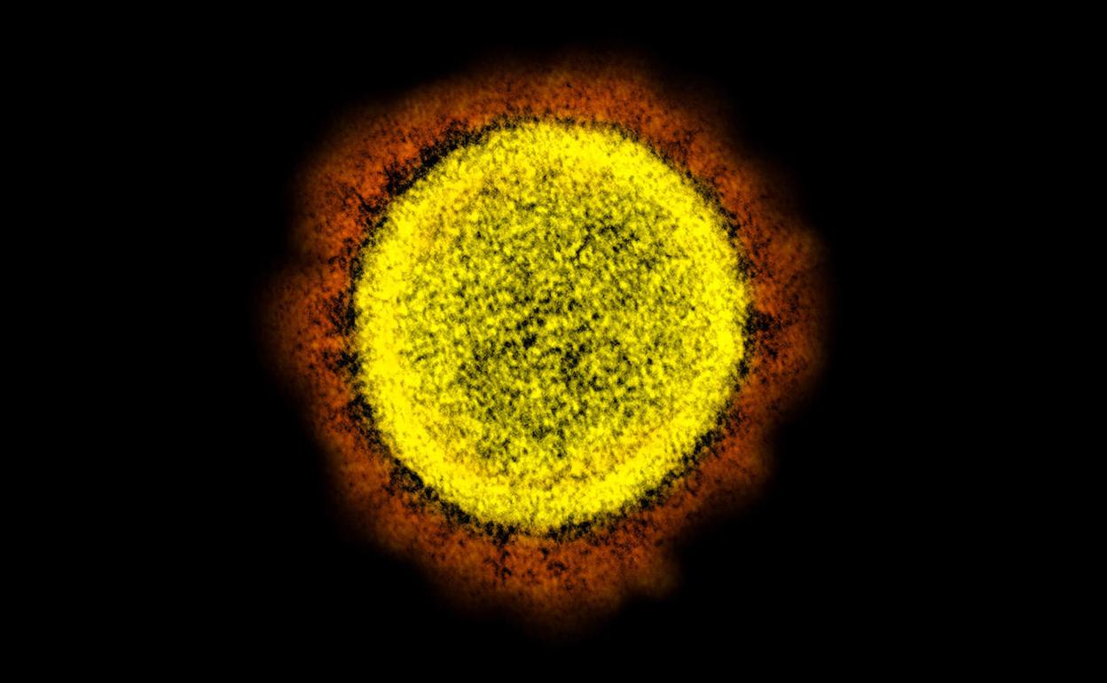 Imagen del coronavirus SARS-CoV-2, causante del COVID-19, tomada con microscopio electrónico, aislado a partir de una muestra de un paciente en EEUU