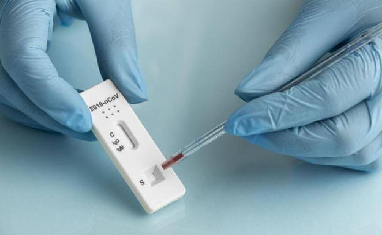 Anticuerpos contra el coronavirus | Las personas que han pasado la covid-19 podrían tener anticuerpos de por vida