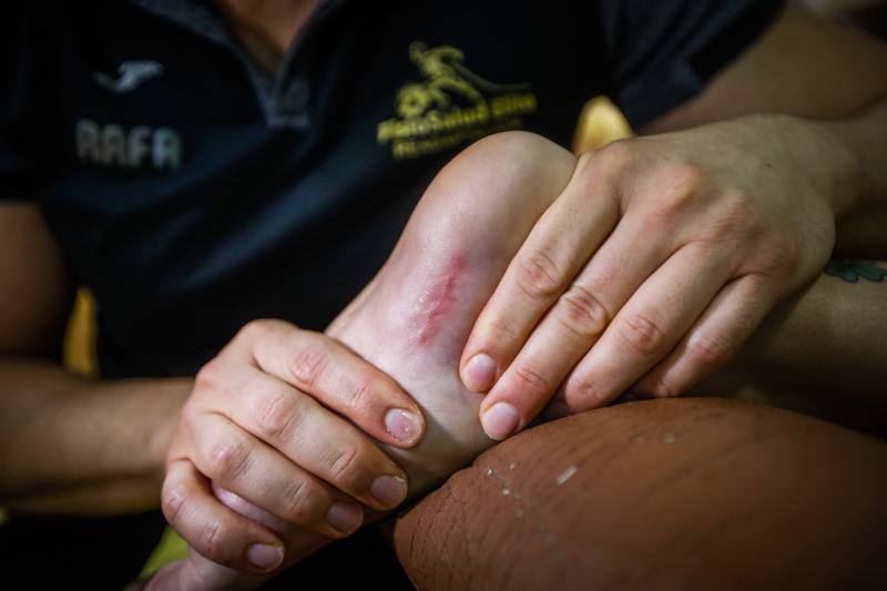 Cicatriz en la planta del pie izquierdo de Laura Bueno. 