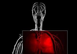 El cardiólogo Juan Jiménez Jáimez explica los síntomas para reconocer una muerte súbita.