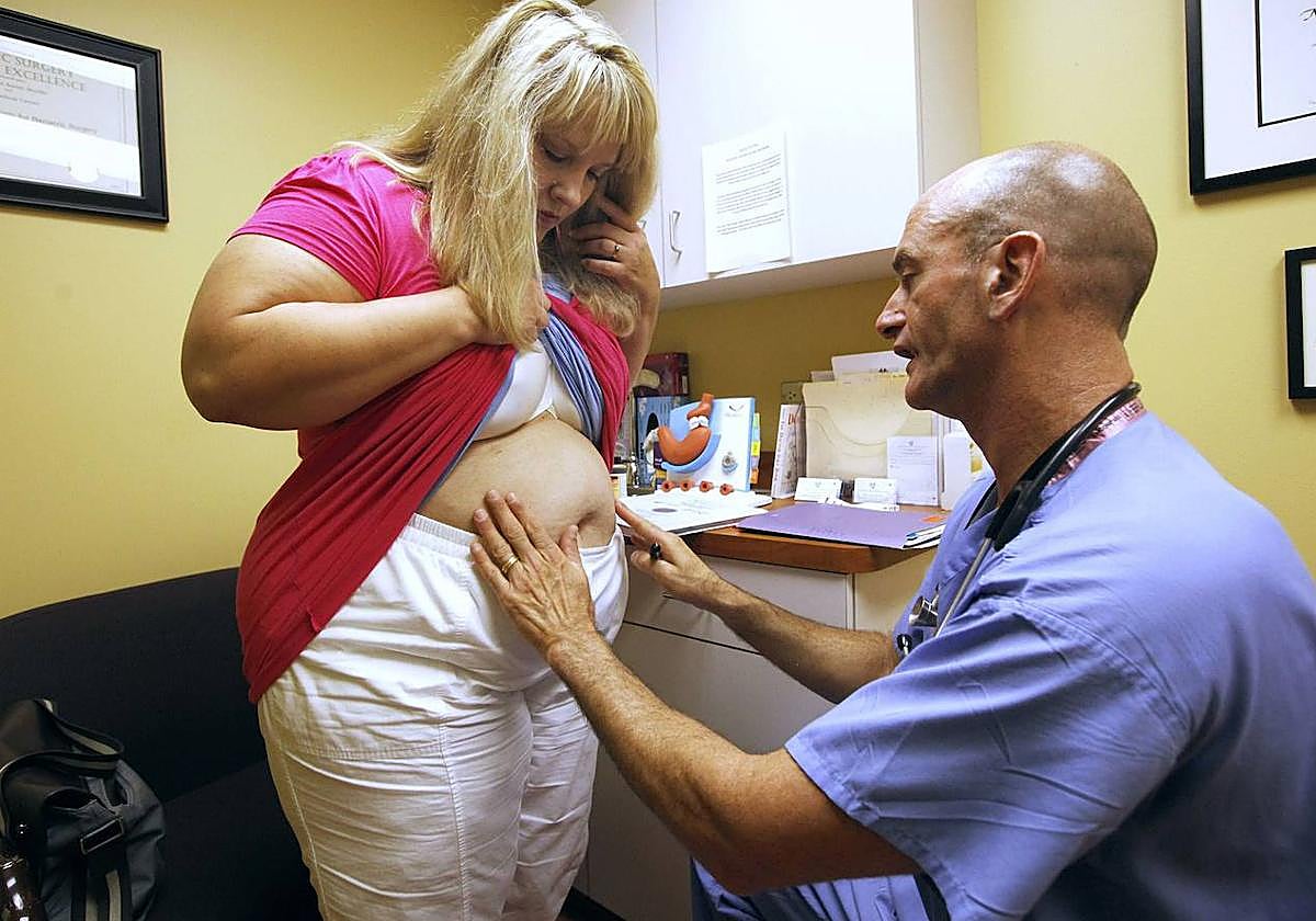 Cirujano bariátrico estudia a una paciente con obesidad.