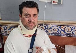José Manuel está herido y muy dolorido tras ser atropellado el pasado viernes en Motril.