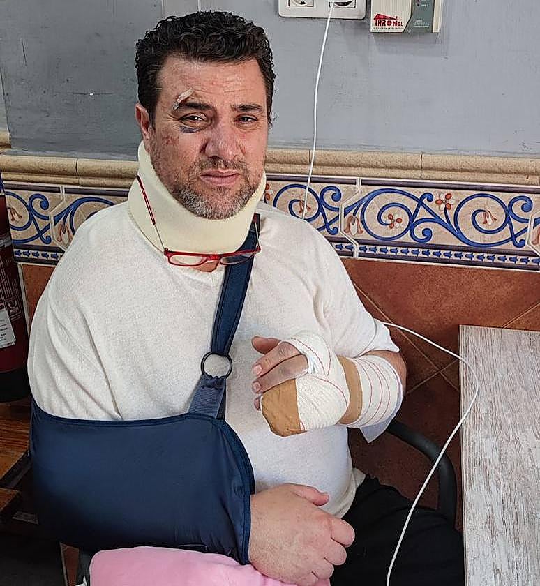 José Manuel está herido y muy dolorido tras ser atropellado el pasado viernes en Motril.
