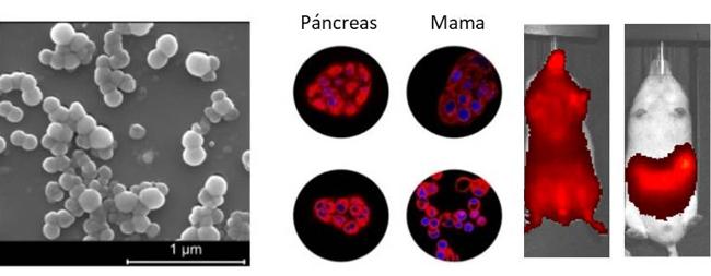 A la izquierda se muestra una imagen de microscopía electrónica de las nanopartículas de ácido maslínico. En el centro se muestra cómo las nanopartículas, teñidas con un compuesto fluorescente, entran con rapidez en células tumorales de páncreas y mama. A la derecha podemos observar su biodistribución en ratones, tanto por vía intravenosa (izquierda) como por vía oral (derecha).