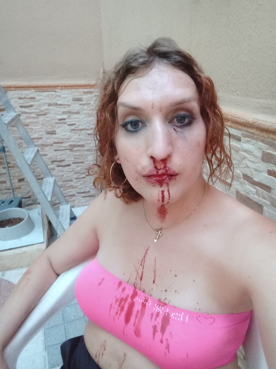 Una vecina de Atarfe denuncia una presunta agresión por ser transexual