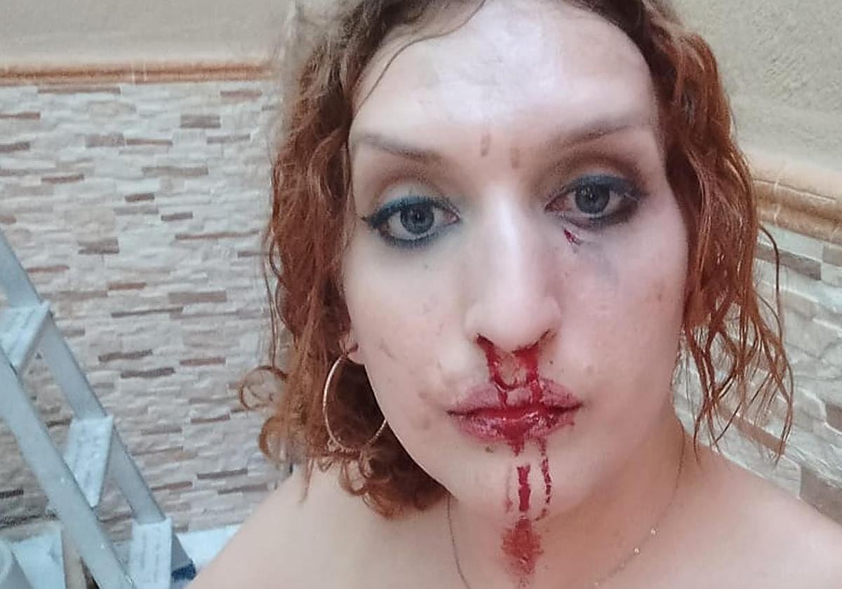 Heridas sufridas por la víctima.