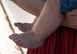 Bebé afectado por los efectos secundarios del omeprazol